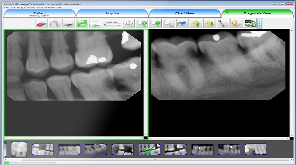 kodak dental imaging software viewer download free